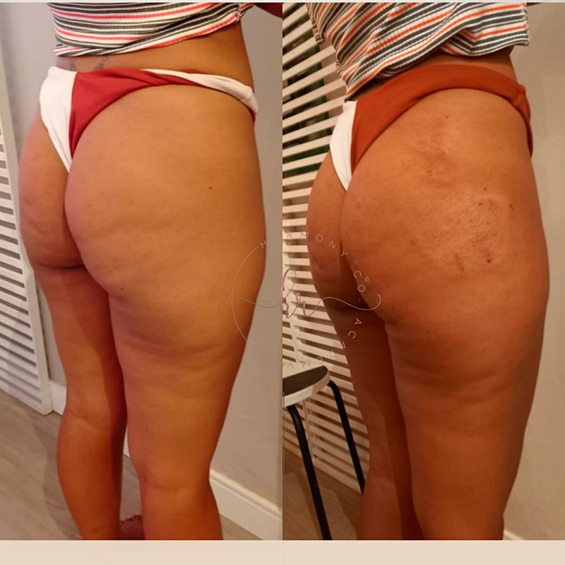 20220327_133328_0000_p