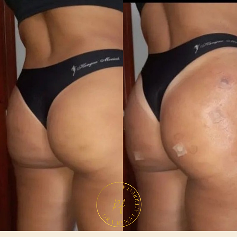 png_20220314_203055_0000_p