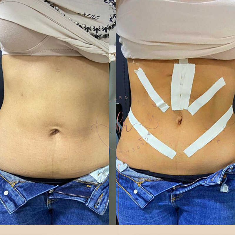 png_20220327_131703_0000_p