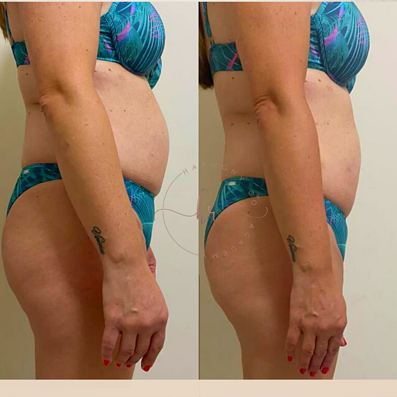 png_20220327_133658_0000_p