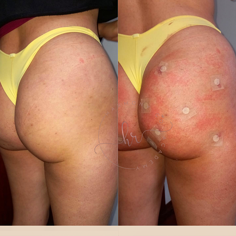 png_20220327_134126_0000_p