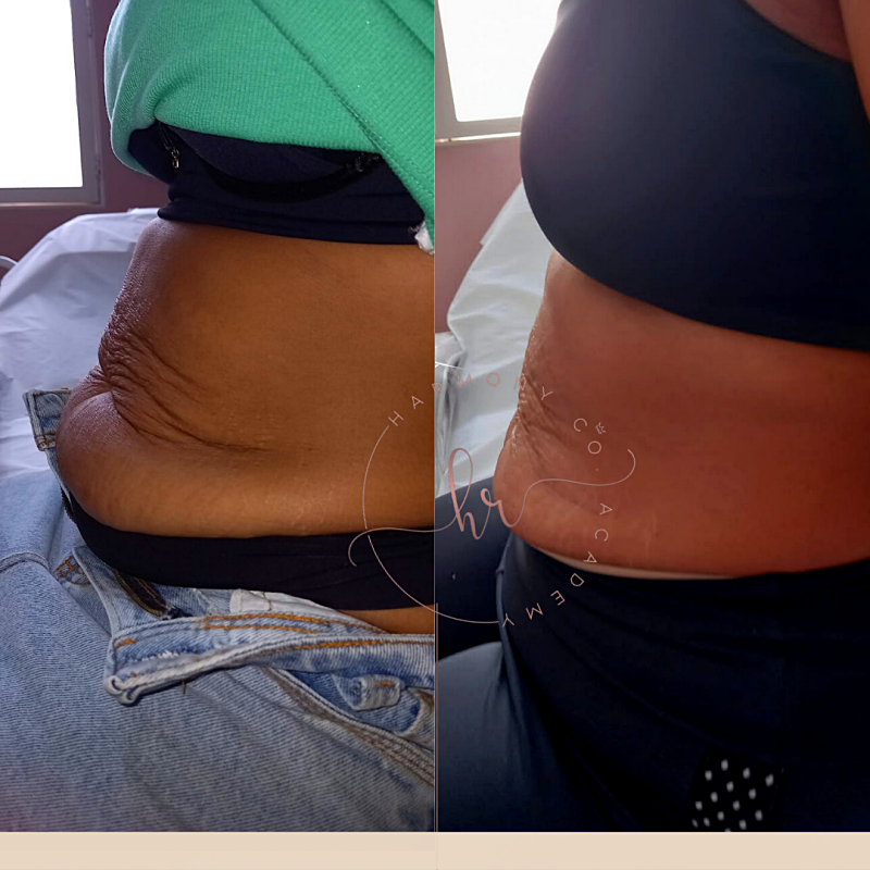 png_20220327_134354_0000_p