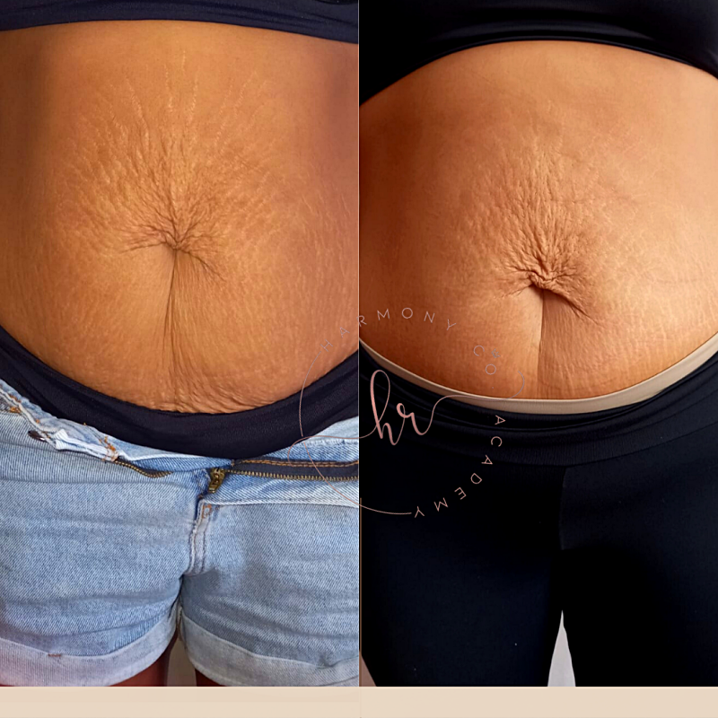 png_20220327_134504_0000_p