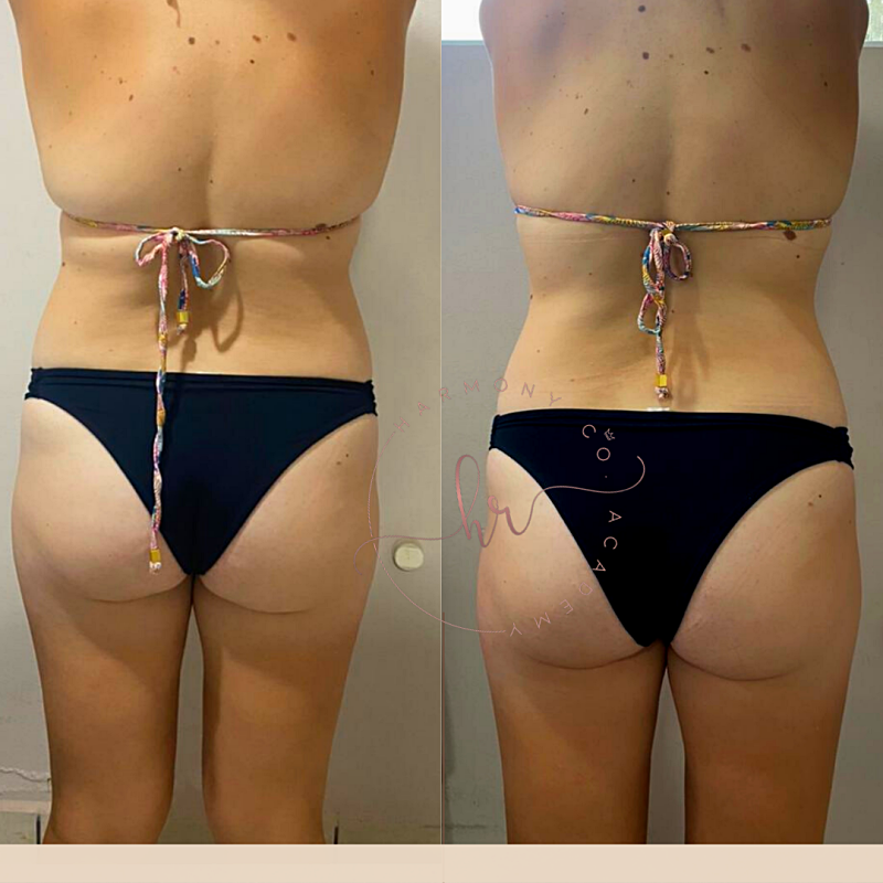 png_20220327_134641_0000_p