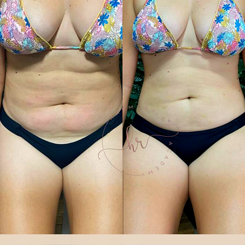 png_20220327_134756_0000_p