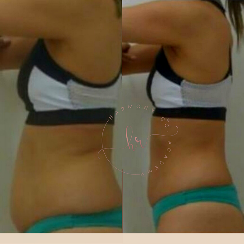 png_20220327_135123_0000_p